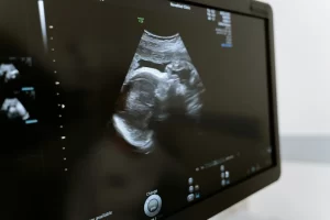 An ultrasound sreen